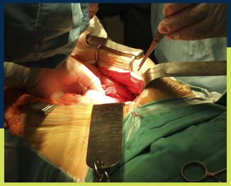 Trauma Surgery